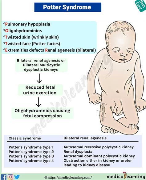 Potter Syndrome – MedicoLearning