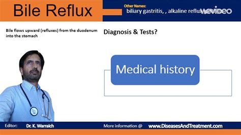 Bile reflux (Acid reflux) : Symptoms, Causes, Diagnosis, Treatment ...