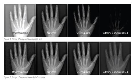 Understanding Radiology Exposure Indicators - Everything Rad