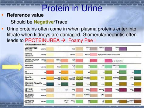 PPT - Urinalysis PowerPoint Presentation, free download - ID:5498707