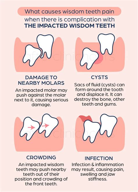 Wisdom tooth extraction and surgery costs in Singapore - what would my total bill look like ...