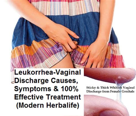 Leukorrhea Causes, Observation & Definition for Treatment of Leucorrhoea - HomeRemedies