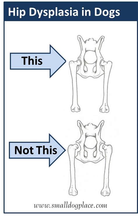 Hip Dysplasia