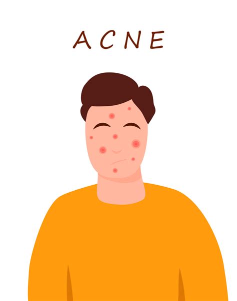 Cartoon teenage character with acne skin. Skin problems concept. Colorful vector illustration ...