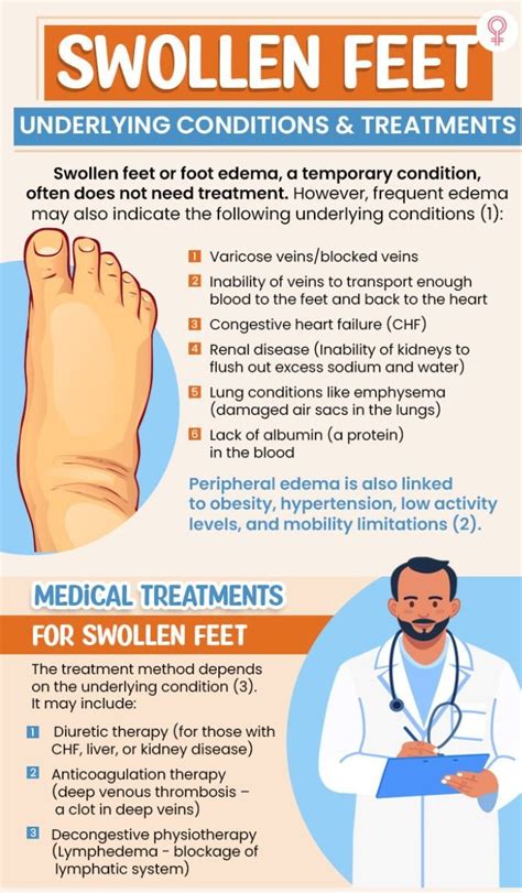 16 home remedies for swollen feet symptoms and treatments – Artofit