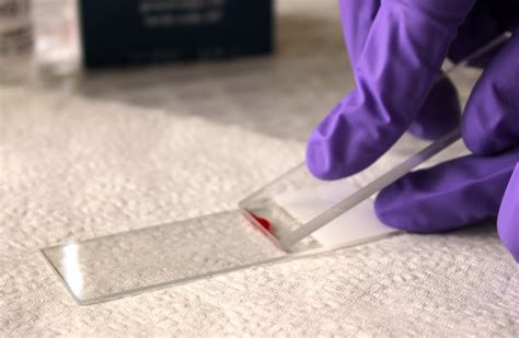 Blood smear technique for veterinarians | Agriculture and Food