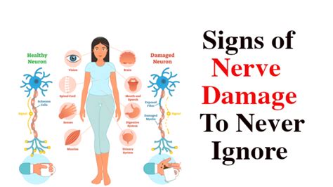 Signs of Nerve Damage to Never Ignore - WomenWorking