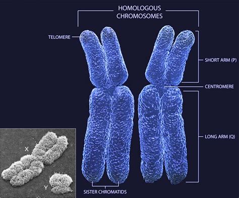 New research has confirmed that the presence of XX sex chromosomes increases the amount of fat ...