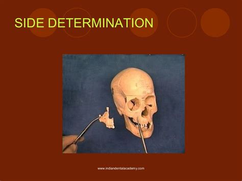 Osteology of maxilla and mandible / oral surgery courses