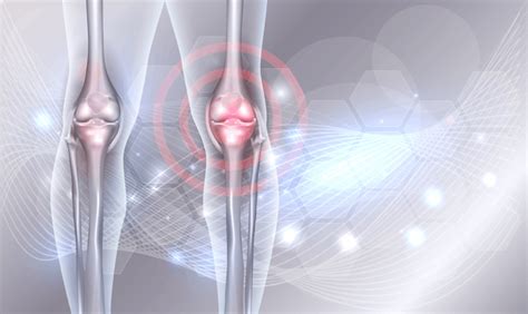 Recovery following a Stem Cell Procedure for Arthritis - Stem Cell Therapy for Arthritis and ...