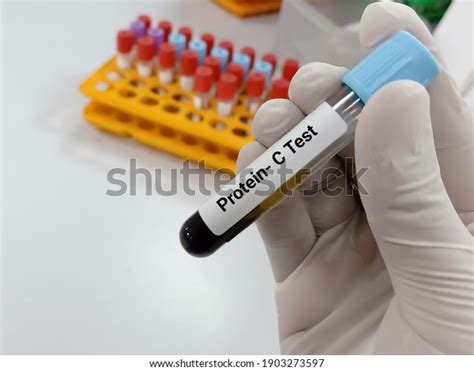 30 Fibrinogen C Stock Photos, Images & Photography | Shutterstock