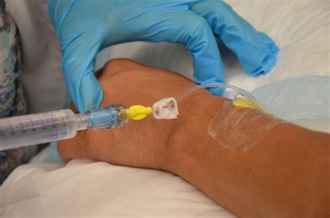 8.5 Flushing a Saline Lock and Converting a Saline Lock to a Continuous IV Infusion – Clinical ...