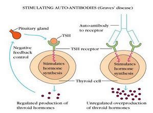 Natural Hypothyroidism Cures: Graves Disease Symptoms : Breaking News ...