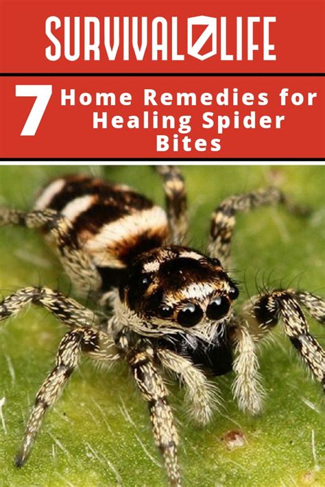 7 Home Remedies for Healing Spider Bites – Survival Life