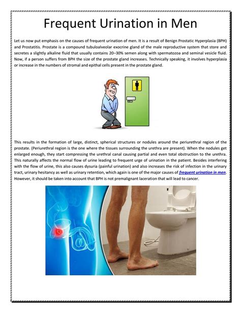 Frequent urination in men by Mike Judd - Issuu