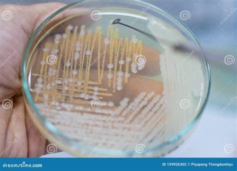 Colony Characteristics of Yeast in Petri Dish. Stock Photo - Image of ...