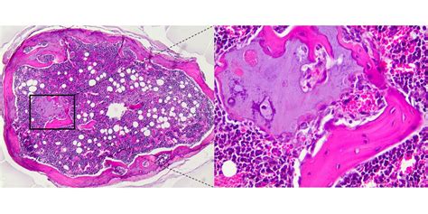 Endochondral Bone Formation Histology