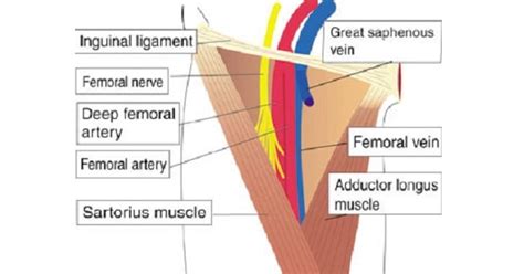 FEMORAL TRIANGLE - New