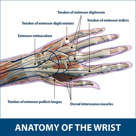 Wrist Tendonitis | Florida Orthopaedic Institute