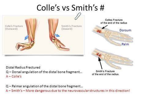 an image of the foot and ankle with different types of tendils on it's sides