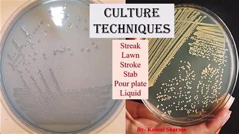 What Is Pan Culture In Microbiology at Lillie Moulton blog