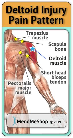 Deltoid Strain