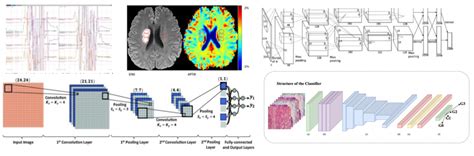 Signal Processing - Centre for Healthcare Science and Technology