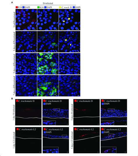 | Calcium-induced differentiation of HaCaT cells decreases the ...