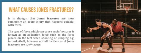 What is a Jones Fracture? All your questions answered here