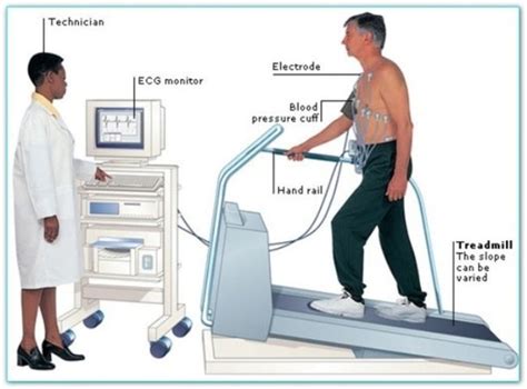 Stress Test Machine ( TMT), Digital at Rs 175000 in New Delhi | ID: 19181675088