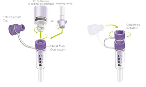 A Brief Introduction of 2023 New Product with ENFit Connector - Fortune Medical Instrument Corp.