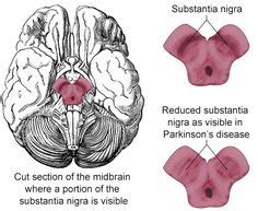 Location of Substantia nigra Brain Help, Circadian Rhythm, Old Things, Nursing, Parkinson's Disease