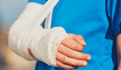 Learn more about the recovery timeline from hand surgery.