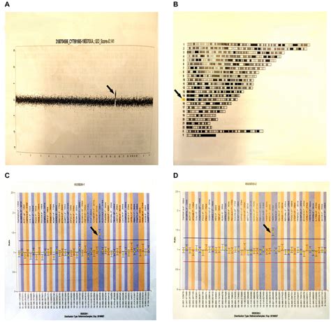 Gene test results. (A) A whole chromosome diagram: This diagram is the... | Download Scientific ...