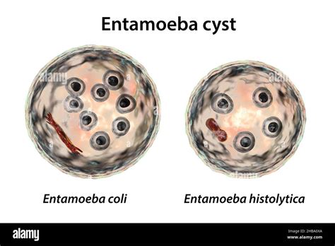 Entamoeba Coli Cysts And Trophozoites