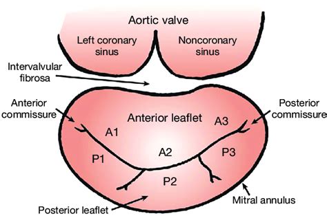 Mitral Valve Diagram