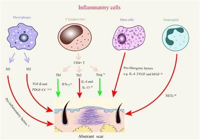 Frontiers | The Roles of Inflammation in Keloid and Hypertrophic Scars