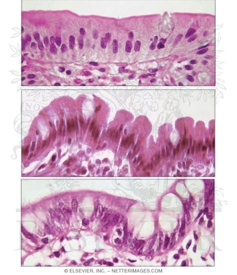 Ileum Histology