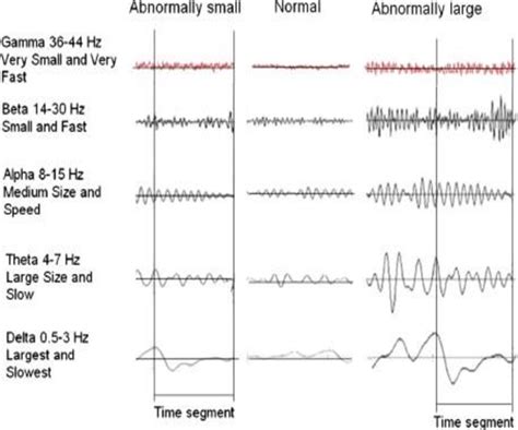 1. EEG Signal Standard Pattern | Download Scientific Diagram