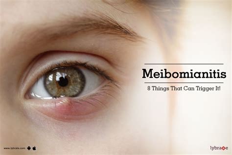 Meibomianitis - 8 Things That Can Trigger It! - By Wavikar Eye Institute | Lybrate