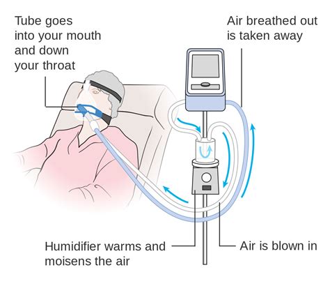 Here’s how a ventilator actually works - Hagerty Media