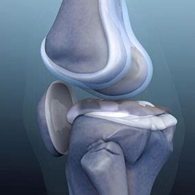 Knee-Noise: Crepitus and Popping Explained