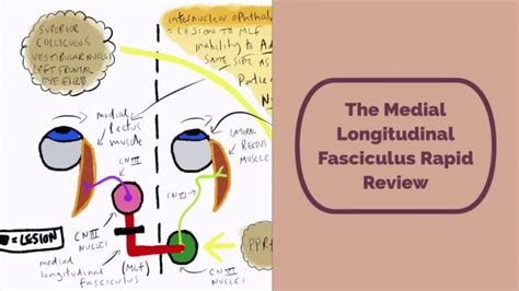 Medial Longitudinal Fasciculus Anatomy