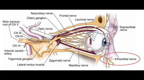 Infraorbital Nerve Blunt Trauma Injury - YouTube