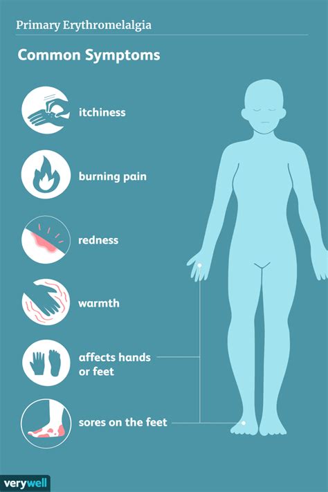 Erythromelalgia: A Very Rare Condition