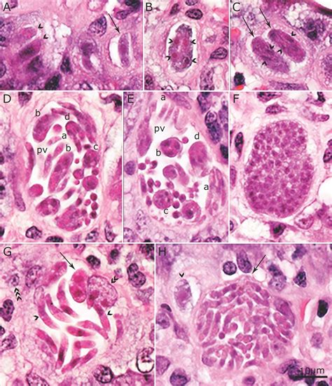 Asexual stages of Cystoisospora canis in the lamina propria of small ...