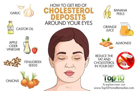 How To Remove Cholesterol Deposits On Eyelids At Home