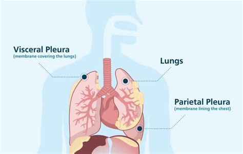 Mesothelioma: Other Mesothelioma Treatment Options