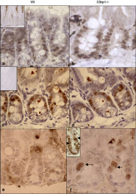 53 and p21 accumulates in 53BP1-deficient used for cells. (a–b)... | Download Scientific Diagram