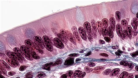 Simple Columnar Epithelium - astonishingceiyrs